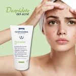 Teen Derm Gel Limpiador x 150 ml - Imagen 4